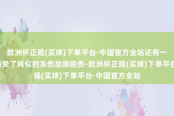 欧洲杯正规(买球)下单平台·中国官方全站还有一些旅客是不严防受了肖似的冻伤加撕脱伤-欧洲杯正规(买球)下单平台·中国官方全站